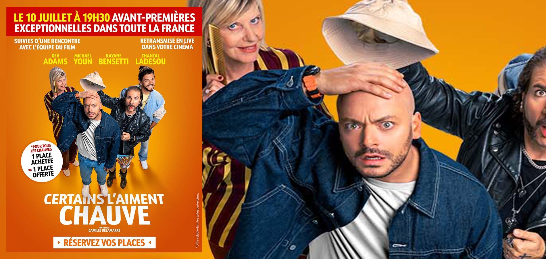actualité chauves